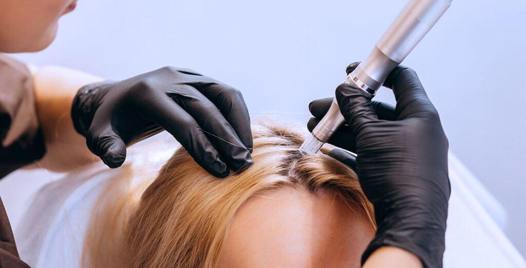 Woman undergoing hair mesotherapy for hair growth.