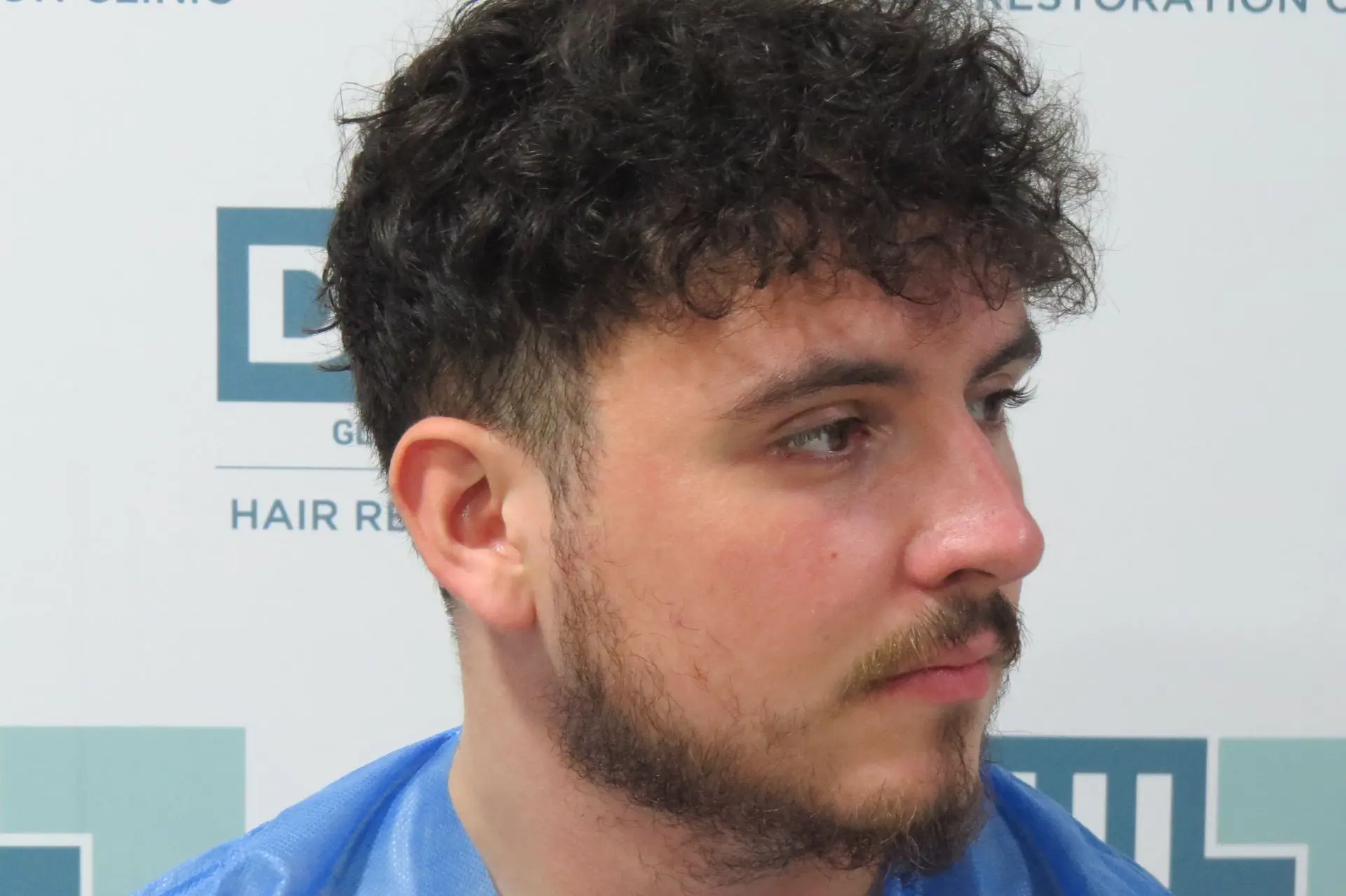 Side Profile Left Guide