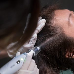 Mesotherapy Mechanism