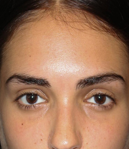 Eyebrow